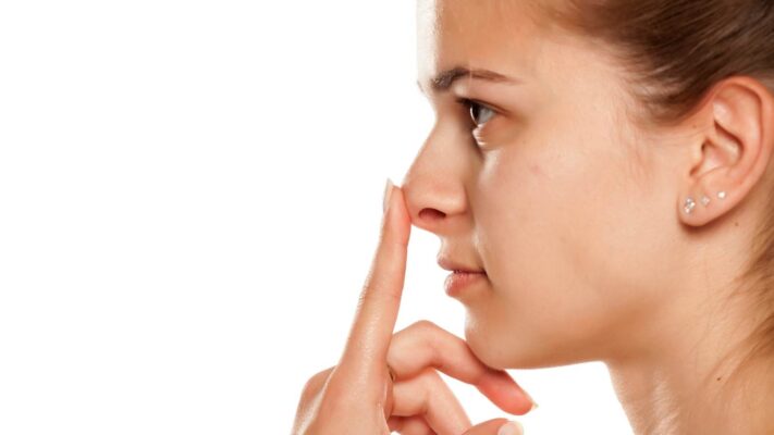 Kalkık Burun Nasıl Düzeltilir?