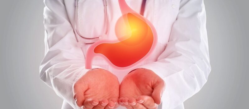 La ce secție și medic ar trebui să merg pentru reflux?