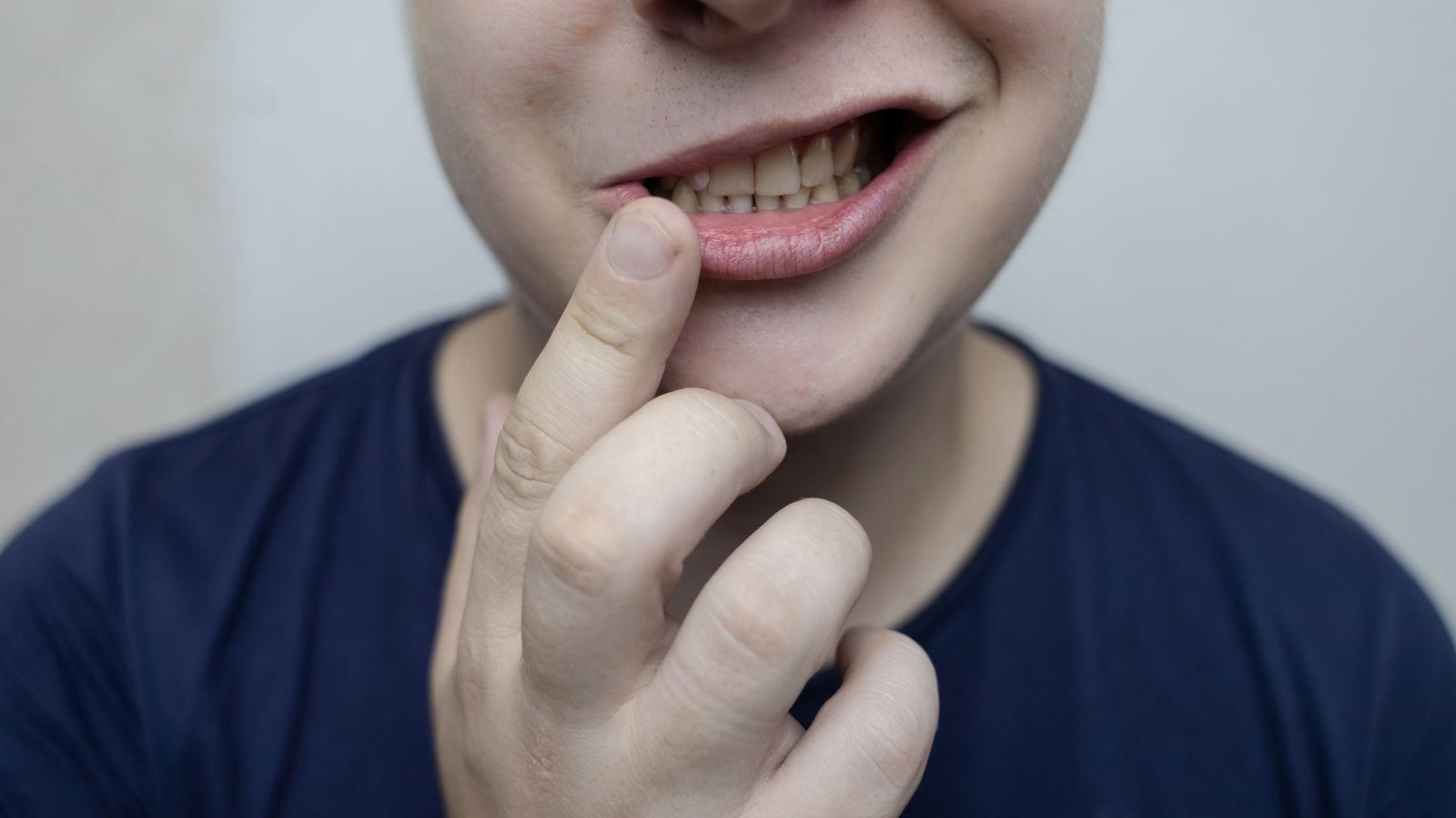 Yüz Felci Geçirenlerin Yorumları