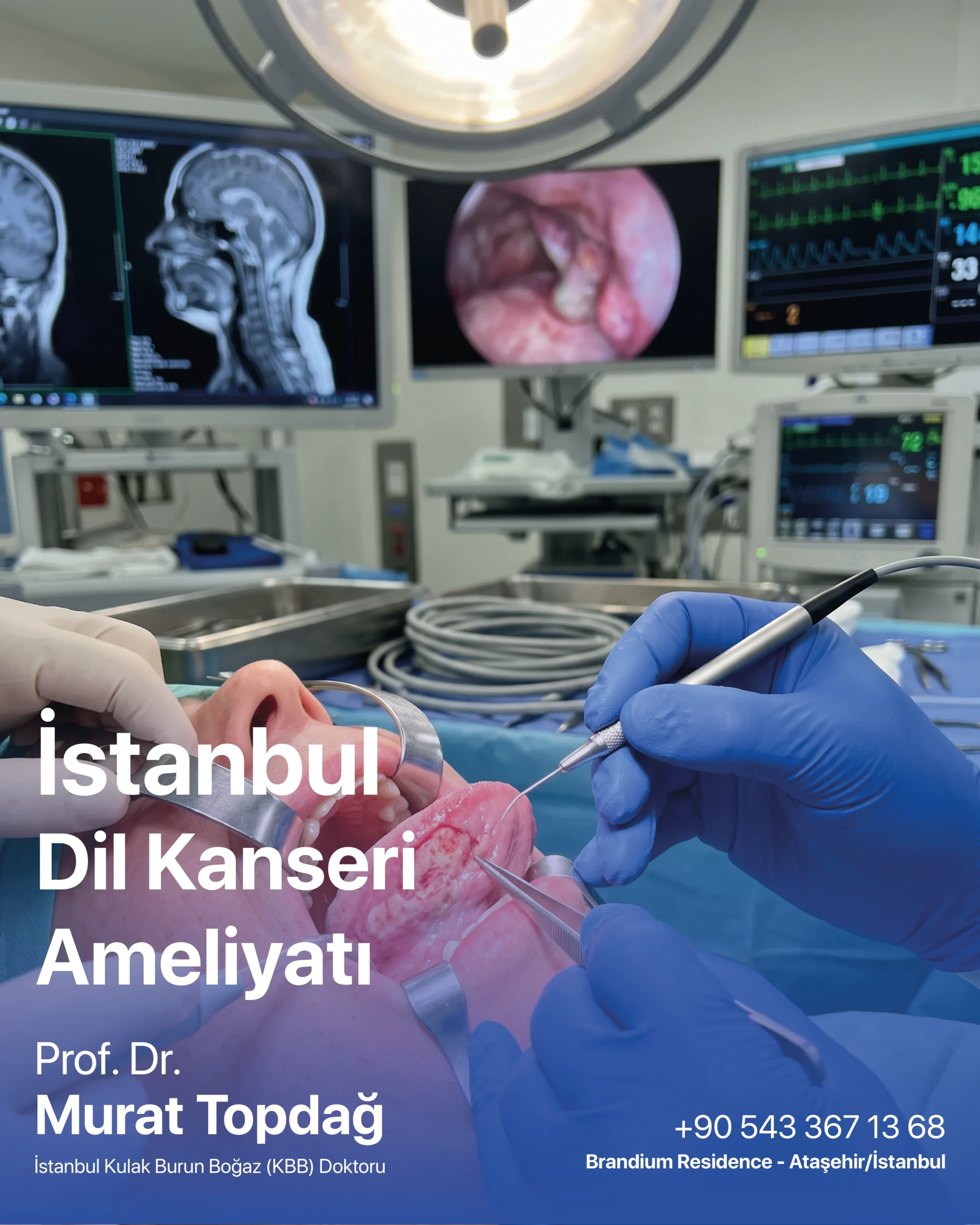 İstanbul Dil Kanseri Ameliyatı