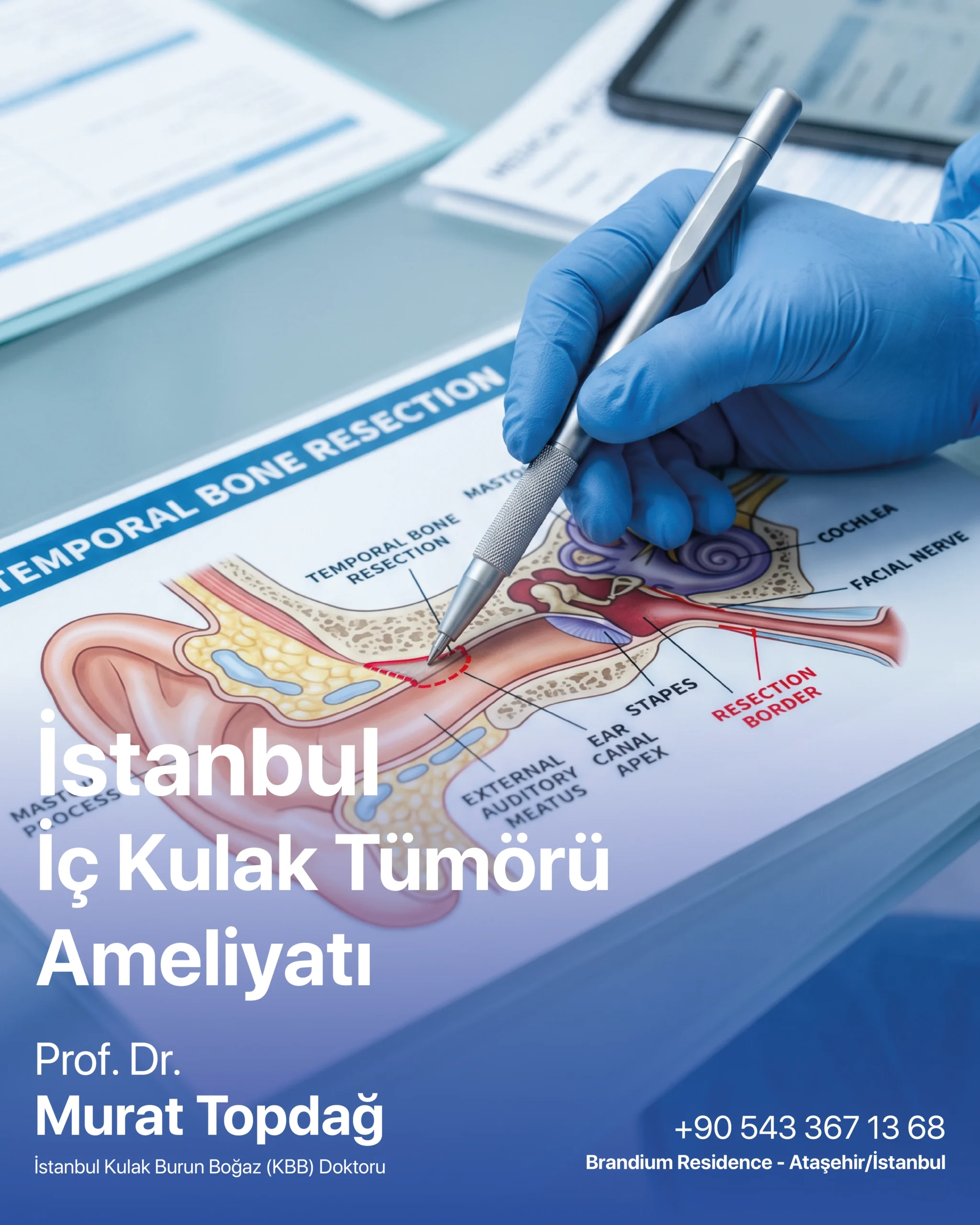 İstanbul İç Kulak Tümörü Ameliyatı