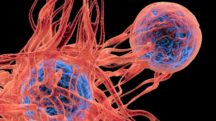 Glomus Tümörü Ameliyatı Olanların Yorumları
